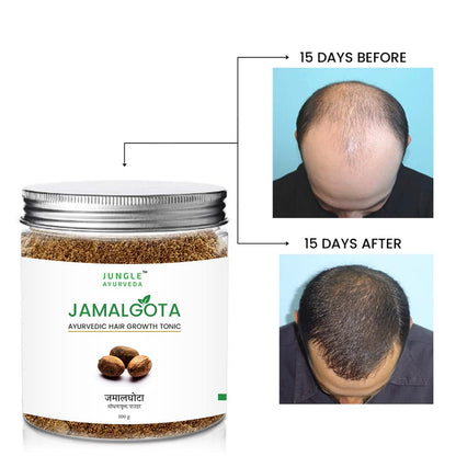 Jamalgota Ayurvedic Hair Growth Powder